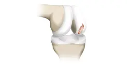 The biomechanical properties of articular cartilage